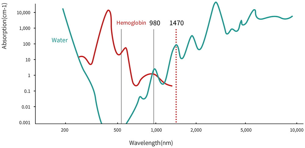 Absorption Coefficient of 980nm 1470nm Laser in Proctology