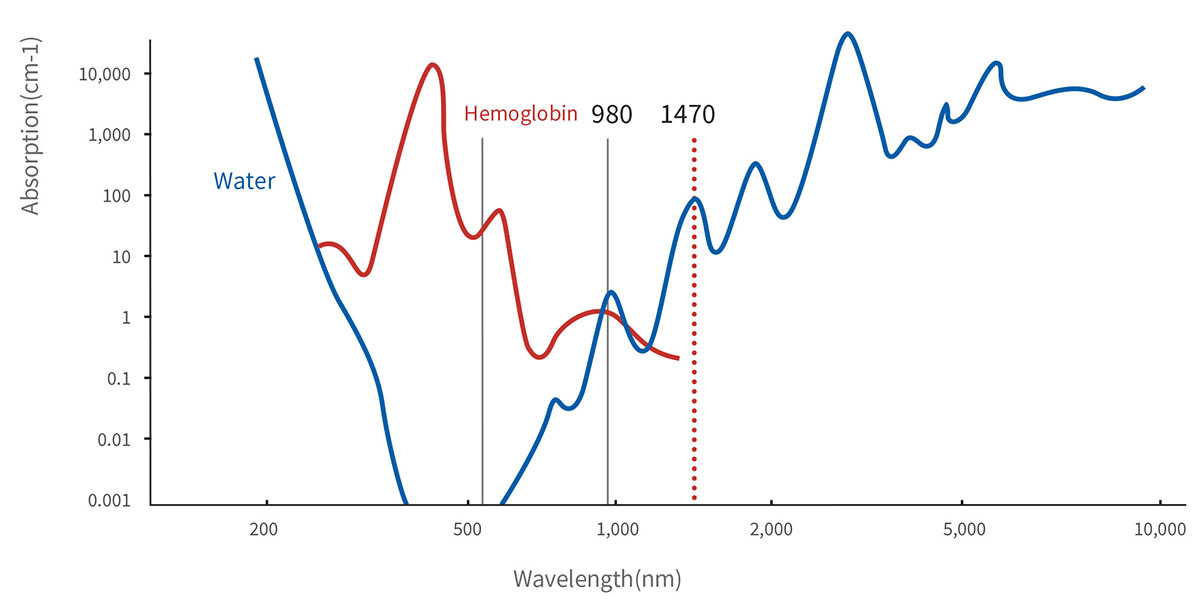 Absorption Coefficient of 980nm 1470nm Laser in Urology Laser Treatment