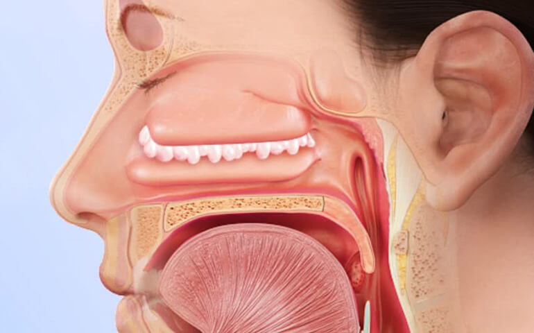 ENT Laser Treatment