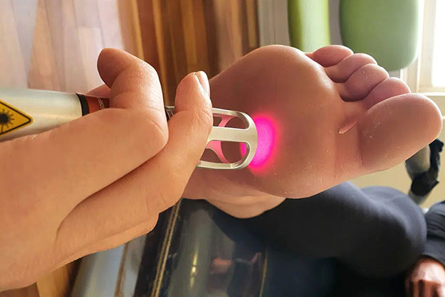 Podiatry Laser Treatment