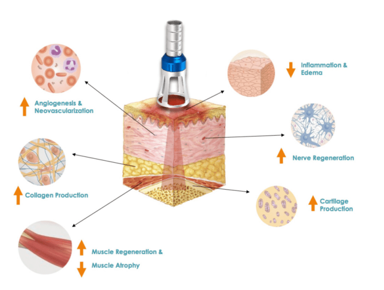 biological benefits of class 4 laser therapy biological benefits of class 4 laser therapy