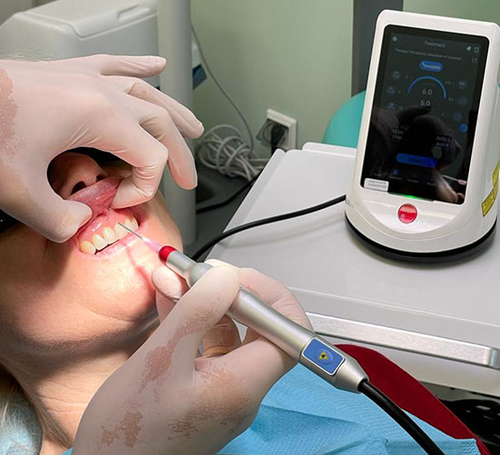 Berylas Dental Laser Surgery