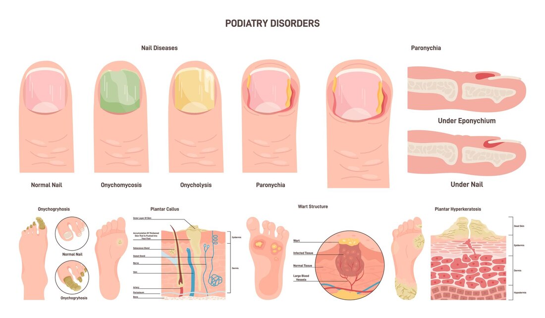 Podiatry Disorders